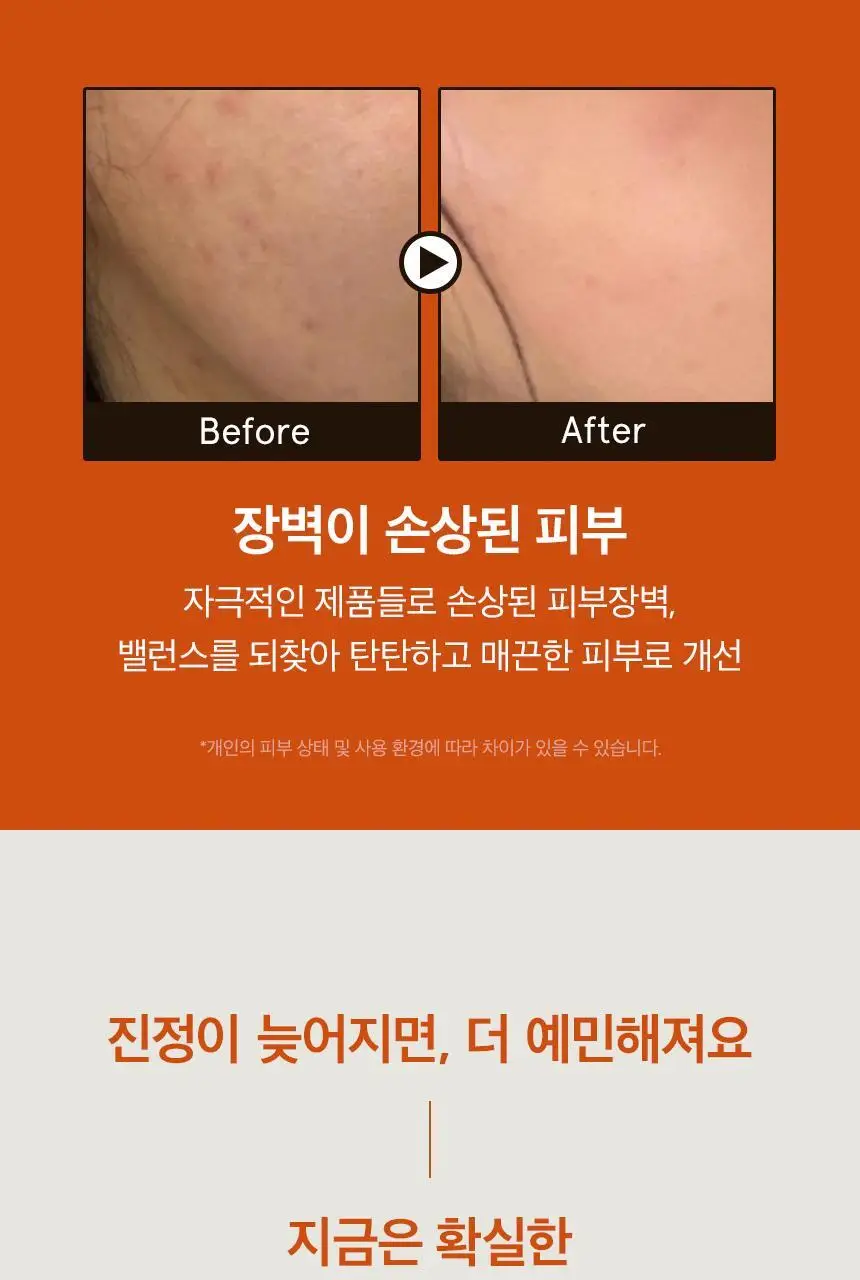 [수분진정/붉은기완화] 원씽 병풀 추출물 토너 150ml 상세페이지 6